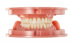 The Baltic Denture System is 100% integrated into the Ceramill workflow. The process provides approximately 60% time savings at the dentist due to needing only two sessions instead of the traditional five. Even more time is saved at the laboratory by eliminating the lengthy set-up process. Prefabricated resin denture blanks are used, and the process is completely digital. High quality is guaranteed due to minimal residual monomer of the resin denture bases.