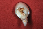 Molar extracted at 33 months.