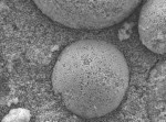 Fig 1. Scanning electron microscope (SEM) images of OMNICHROMA at 5,000X magnification. Note the uniformity of the spherical fillers.
