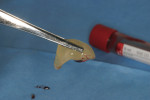 Figure 3  The L-PRF plug after removal from the centrifuge tube.
