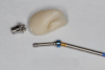 Anterior screw-retained crown with angled screw channel to provide lingual access.