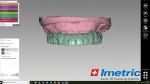 Fig 18. The prosthesis is designed using CAD software.