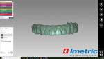 Fig 22. The prosthesis is designed using CAD software.