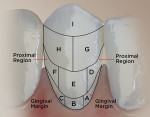 Fig 1. Rustogi Modification of Navy Plaque Index. Plaque is assessed for each tooth area (A through I) and scored using the following scale: 0 = absent, and 1 = present. Facial and lingual surfaces of all gradable teeth are scored and a mean plaque index is calculated for each subject at each examination. Subjects’ scores were calculated for the whole mouth (A through I), along
 he gingival margin (A through C), and at the proximal (approximal) areas (D and F).