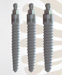 Sterngold is the leader in the mini implant market thanks to the MOR Mini Dental Implant System. The popularity of MOR implants stems from affordability, simplicity, versatility, and high potential to deliver patient satisfaction. It is a true option for patients who want the benefit of an implant-retained, tissue-supported denture without the high costs typically associated with this type of treatment.