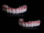 Fig 8. This case offers an example of a full contour monolithic zirconia arch.