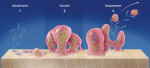 Figure 1  The biofilm life cycle in three steps: attachment, growth of colonies, and detachment in clumps. (Adapted from Peters LB. Desinfectie van het wortelkanallstelsel bij de endodontishche behandeling. Ned Tijdschr Tandheelkd. 2005;112:461-512(p