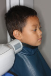 Pediatric patient requiring bitewing radiographs.