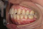 Fig 6. Pretreatment intraoral photographs.