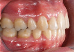 Fig 15. Post-treatment intraoral photographs.