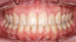 Fig 16. Post-treatment intraoral photographs.