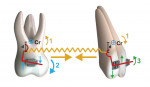 Fig 20. System of forces and moments created by the segmented mechanics for incisor retraction. (1) The applied force at the power arms produces a clockwise moment in the center of resistance (Cr) of the incisors and a counterclockwise moment in the Cr of the molars. (2) The applied force at the molar tube produces a clockwise moment in the Cr of the molars. (3) The applied force at the bracket produces a counterclockwise moment in the Cr of the incisors. (d = distance between the line of force to Cr)