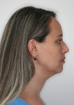 Fig 12. Post-treatment facial photographs.