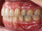 Fig 17. Post-treatment intraoral photographs.