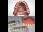Fig 3. A printed base has specially designed tooth sockets to cradle the denture teeth into position for permanent bonding.