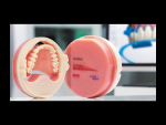 Fig 5. This conversion denture—teeth with base—is milled simultaneously, without the need to bond multiple segments.