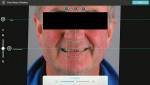 Fig 3. Smile design planning: facial landmarks.