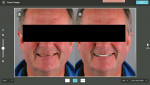 Fig 5. Smile design planning: 2D comparison.