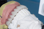 Fig 8. The teeth section printed in white try-in resin after mechanical adjustment; note that occlusal contacts were now evenly distributed.