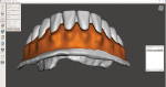 Fig 16. The reduced area was colored orange, with a -1.0 mm reduction indicated in the extrude toolbox.