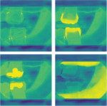 Fig 1. Computer vision models identifying basic oral features. The panel illustrates images being processed by machine learning algorithms in order to detect and predict various findings of clinical importance highlighted in yellow. These images are not presented to practitioners directly but instead inform a final diagnostic assistance tool (Fig 2). In this image set, models identify CEJ points (upper left), enamel (upper right), restorations (lower left), and bone (lower right). Source: Overjet Inc.