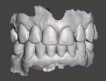 Fig 3. Digital scans of patient’s maxilla and mandible.