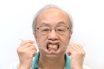 Fig 4. Standard digital smile design retracted view with the patient wearing his denture.