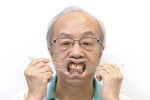 Fig 4. Standard digital smile design retracted view with the patient wearing his denture.