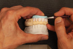 Fig 11. A 3D printed model of the approved provisional restorations was utilized as a side-by-side reference during precontouring of the final layered porcelain veneers.