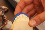 Fig 15. After firing, the provisional index was used as a reference to verify the ceramic structure of the incisal opal effects.