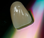 Figure 13  Heraeus Mondial® teeth with NanoPearls® filler material was used.