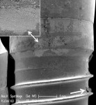 Fig 7. DAE implant surface treated with CO2 9,300 nm laser. Visual score of mostly effective is confirmed by SEM examination. A few fragments of resin cement remain (single arrow). Smooth collar of implant exhibits evidence of shallow etching effect from laser irradiation (double arrow). Original magnification of 21x, Bar = 1 mm. Inset, original magnification of 100x, Bar = 200 μm.