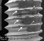 Fig 9. SEM of DAE implant surface in Fig 8 revealed a significant amount of residual cement between the threads (thin arrows). Piezo scaler–induced smearing and flattening of the thread crests are notable (thick arrows). Similar findings were observed with the CO2 10,600 nm + piezo scaler protocol. Original magnification of 20x, Bar = 1 mm.