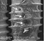 Fig 11. Cavitational defects (arrows) in the residual cement between the threads correspond to the visible damage apparent in Fig 10. Original magnification of 20x, Bar = 1 mm.