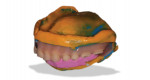 Fig 2. An existing denture used for “reference denture” protocols.