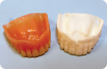 Fig 5. An existing denture and a duplication in tooth-colored polymer.