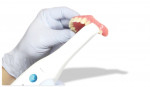 Fig 10. Existing dentures are scanned.