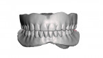 Fig 11. Scan of existing dentures.