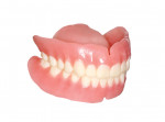 Fig 28. Due to the proprietary design and production of the try-in, after records are complete and scanned, the try-in itself can be processed via normal relining/rebasing procedures to produce an economy denture as a backup or transitional/healing prosthesis.