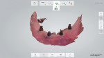 Fig 7. An optical scan of the edentulous ridge with denture housings (F-Tx Denture Attachment Housings, Zest Dental Solutions).