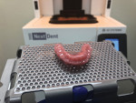 Fig 9. The prosthetic base is 3D printed using biocompatible pink colored resin (Denture 3D+, NextDent) and joined together with the prosthetic teeth in the laboratory.