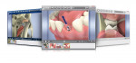Figure 2   Guru 5 comes with a full library of hundreds of 3D animations covering dental procedures and techniques.