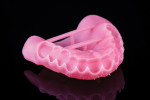 The final denture base printed from the approved file.