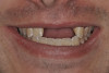 Figure 22   Occlusal view of the finished preparation.