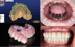 The exocad suite of software applications provides a complete solution for digital dentistry.