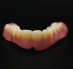 Fig 17. The final denture after milling from a monolithic block and assembly.
