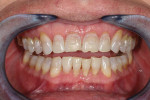 Fig 3. Post-orthodontic treatment.