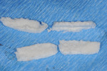 Fig 3. Two pieces of 6-mm-thick VSCM (bottom row) were thinned almost in half leaving 4 mm of thickness. The 4-mm-thick pieces (top row) will be placed and sutured under the buccal flap from sites Nos. 21 through 28 for phenotype conversion.