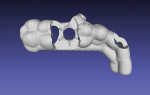 Fig 7. Surgical template design, occlusal view.