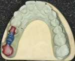 Figure 3  Occlusal view of the wax-up.